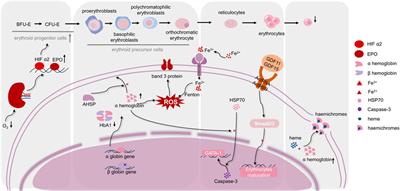 The interactions between ineffective erythropoiesis and ferroptosis in β-thalassemia